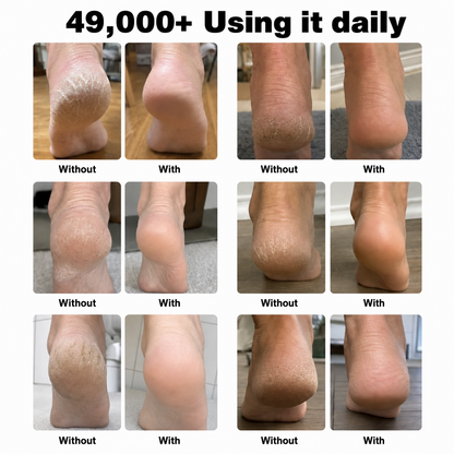 Deep-Softening Sakura Heel Balm — for Mature Skin